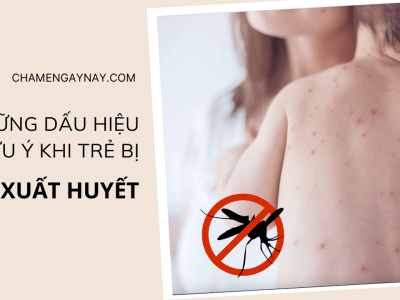 sot xuat huyet